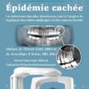 épidémie cachée, T.E. Levy